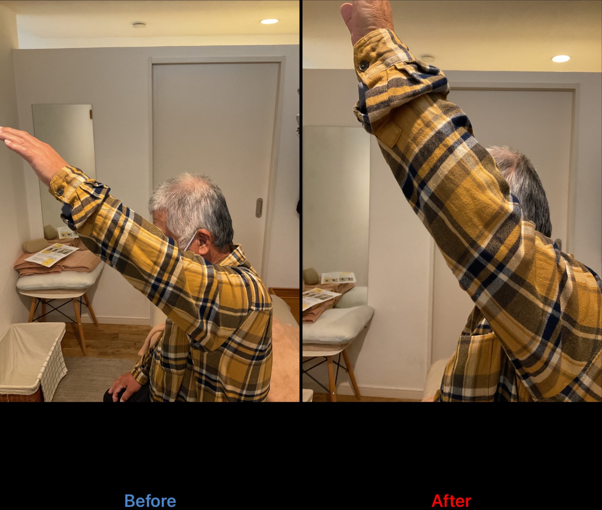 整体と鍼灸の施術前後で肩の可動域が改善したビフォーアフター写真